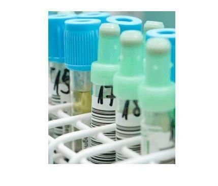 液體藥劑 非即飲型茶的創新應用與市場前景